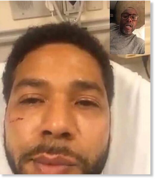 Click to enlarge Director and “Empire” creator Lee Daniels shared a screengrab showing Jussie Smollett’s injuries.