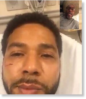 Click to enlarge Director and “Empire” creator Lee Daniels shared a screengrab showing Jussie Smollett’s injuries.