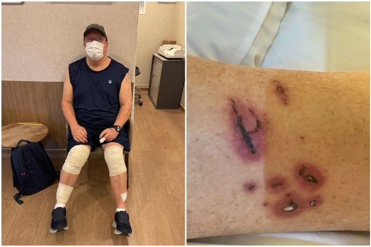 Click to enlarge Mr Graham George Spencer was attacked by otters on the morning of Nov 30, 2021, and was left with injuries to his legs, buttocks and finger.