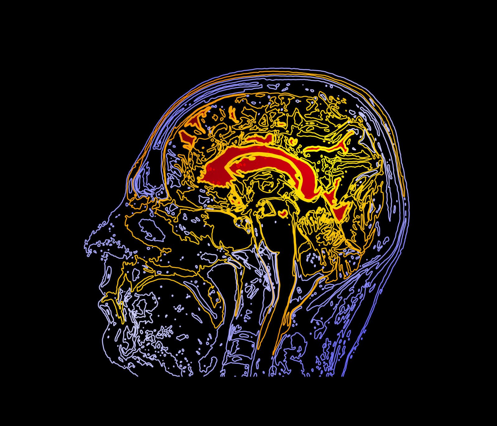 human brain map