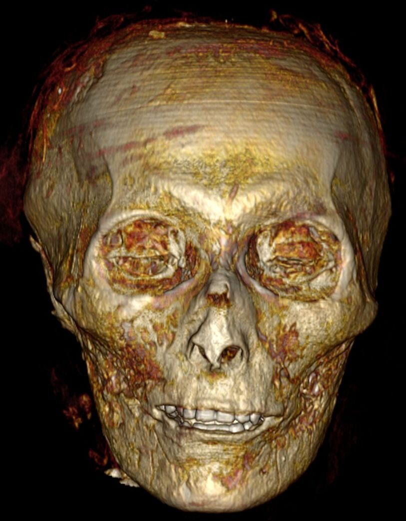 Click to enlarge The pharaoh’s full set of teeth.