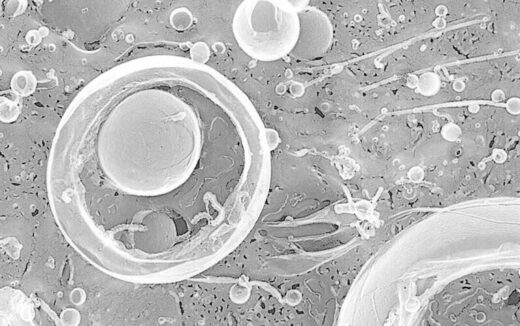 Corynebacterium glutamicum vesicle formation