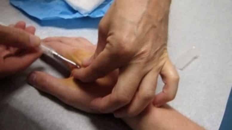 Click to enlarge chip injection