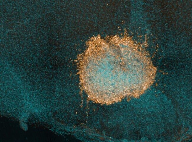 white blood cell