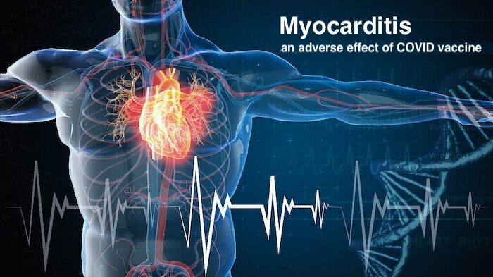 Myocarditis