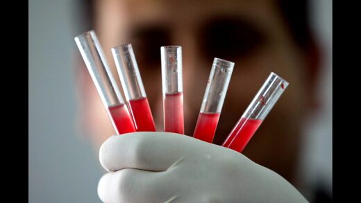 Golden blood: The rarest blood type in the world