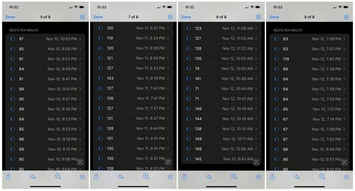 joseph keating mycarditis apple watch heart data