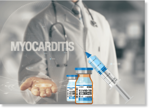 myocarditis