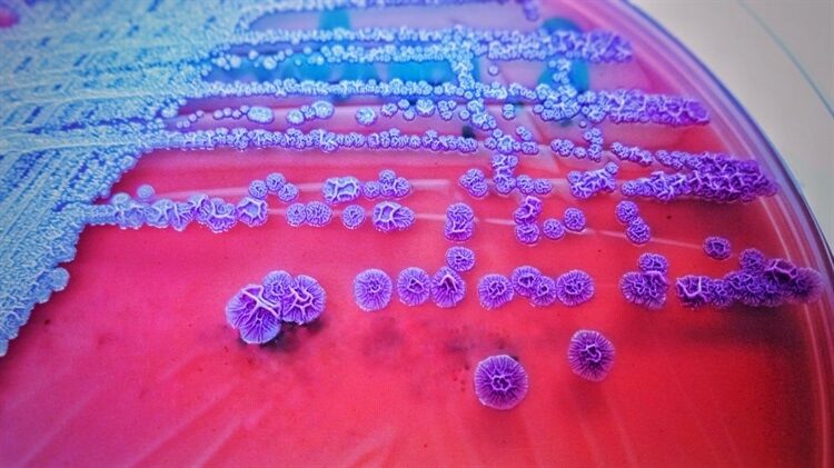bacterial antimicrobial resistance
