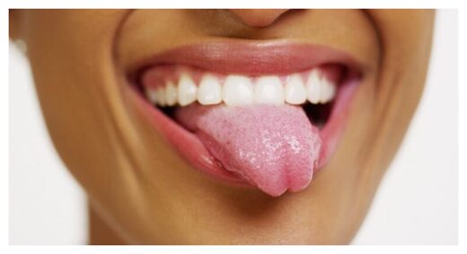 bioelectronic tongue