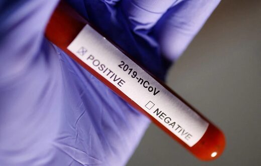 covid test tube