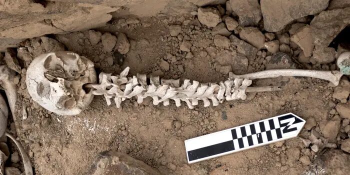 Click to enlarge spine and skull
