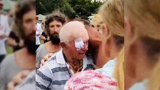 man injured australia protest
