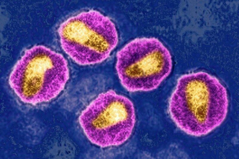 Click to enlarge HIV virus