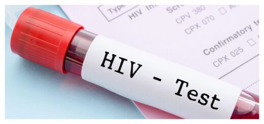 HIV Test