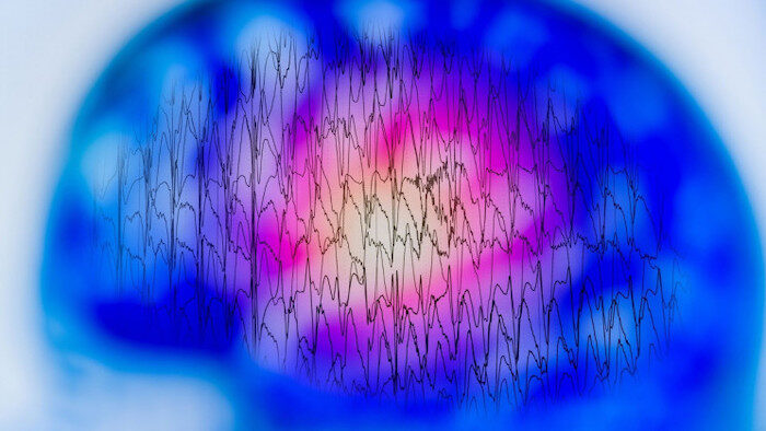 Brain waves