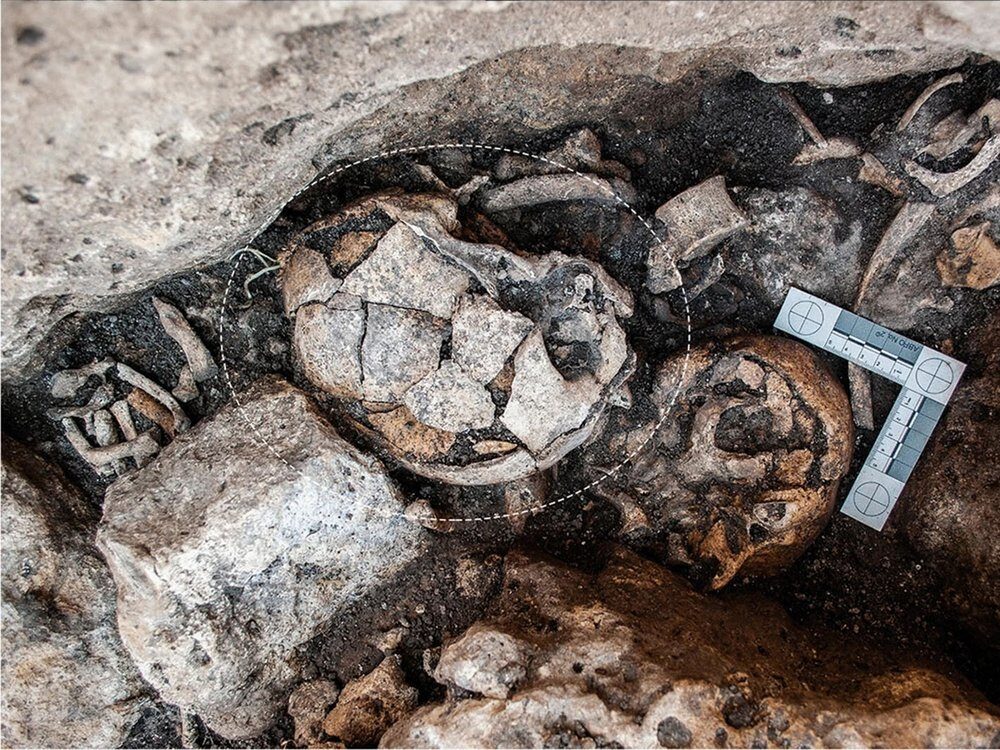 ancient ear surgery skull