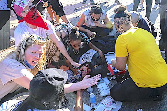 Man down Floyd Protest