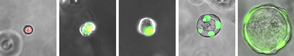 Click to enlarge lung cells