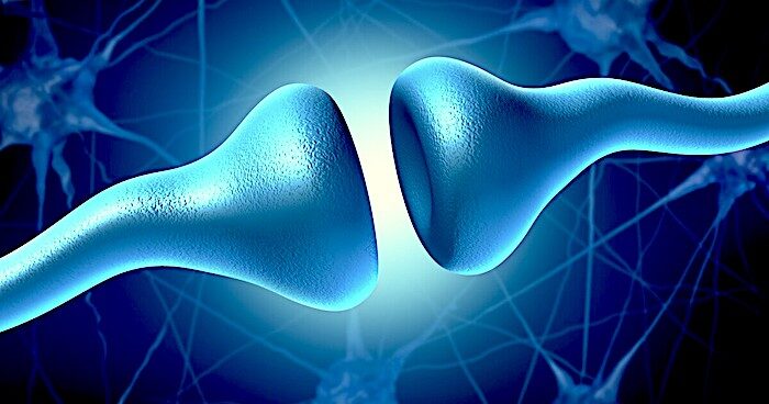 Alzheimer image