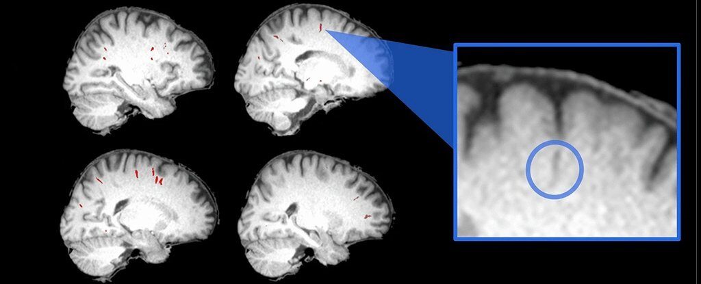 astronaut brain