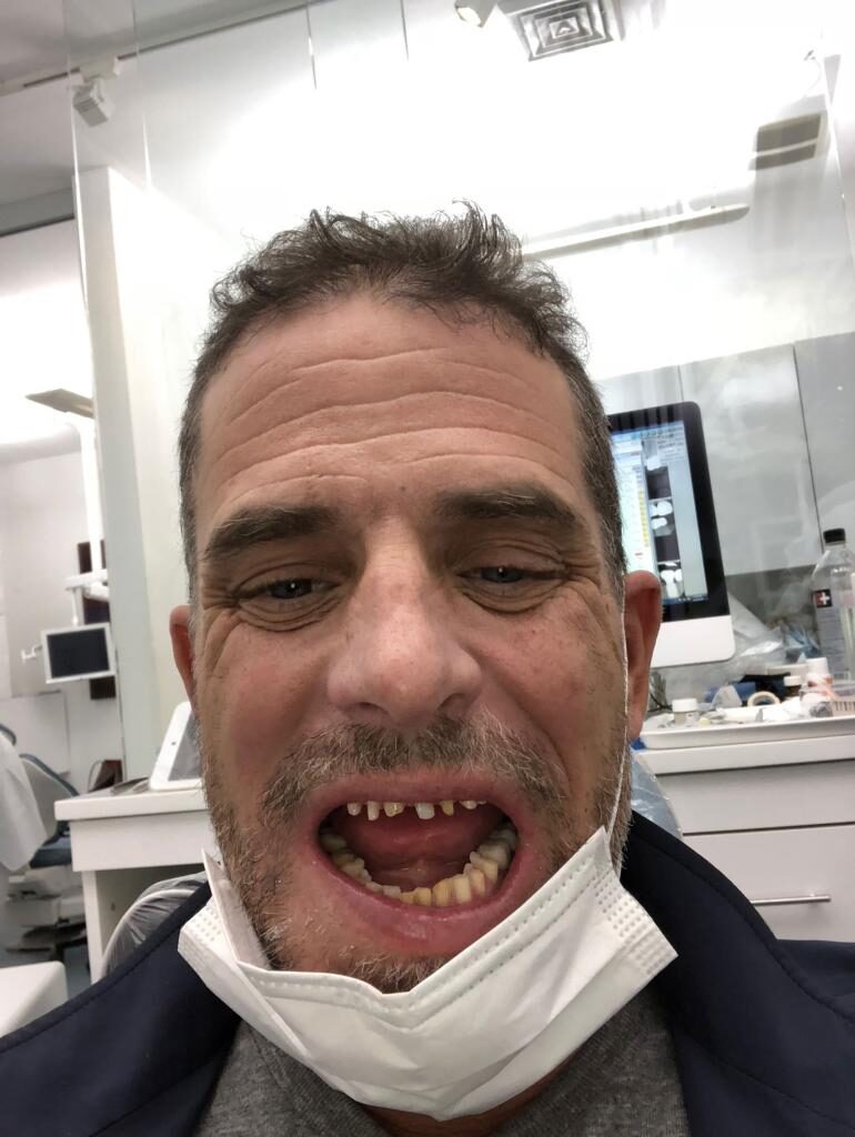 Click to enlarge hunter biden photo lapt sop meth teeth