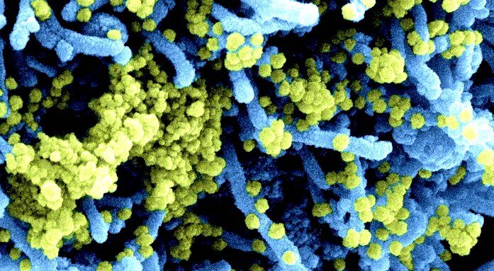 hepatitis