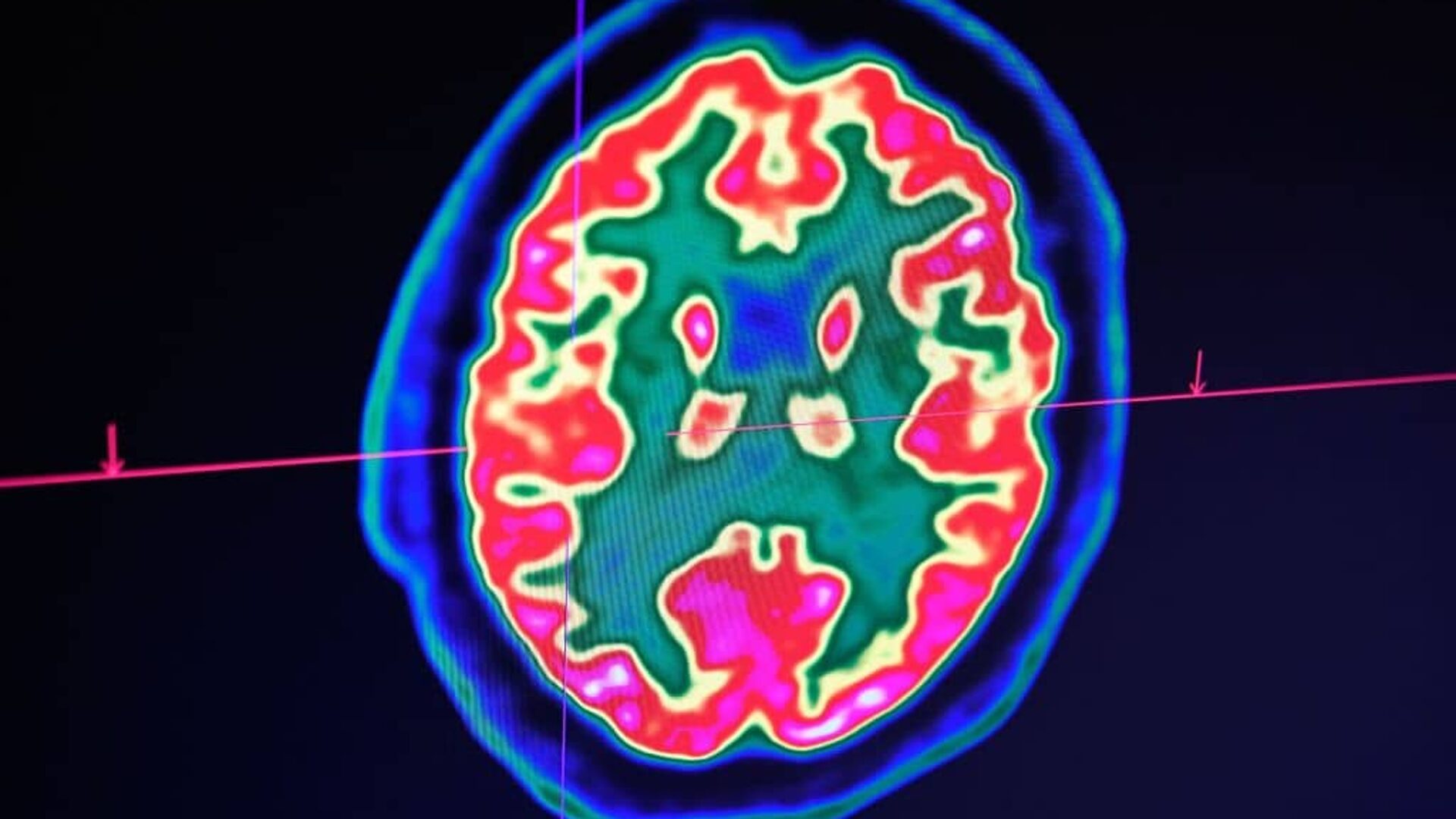 Click to enlarge brain imaging scan