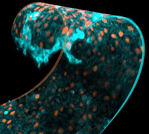 cells swell curved tissue