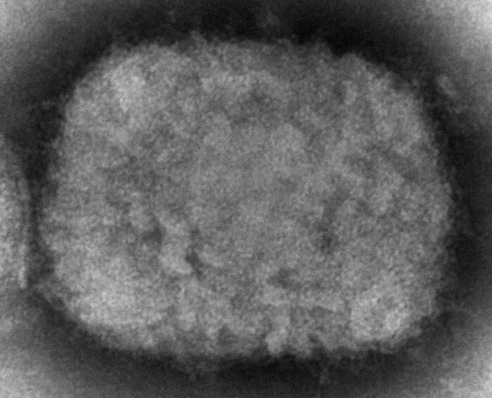 Click to enlarge monkeypox