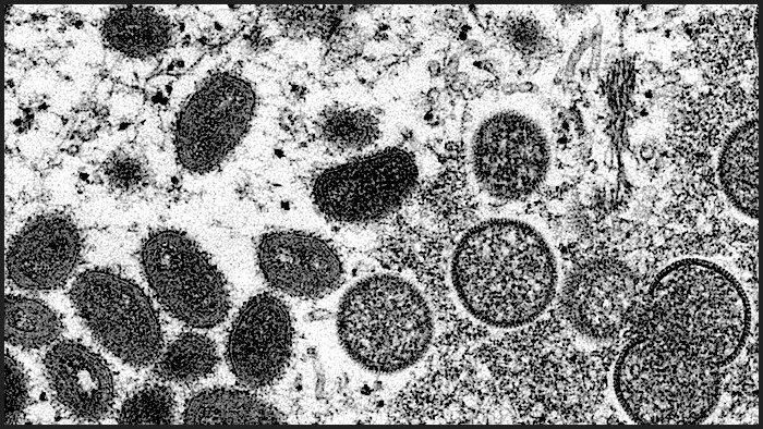 Click to enlarge monkeypox under microscope