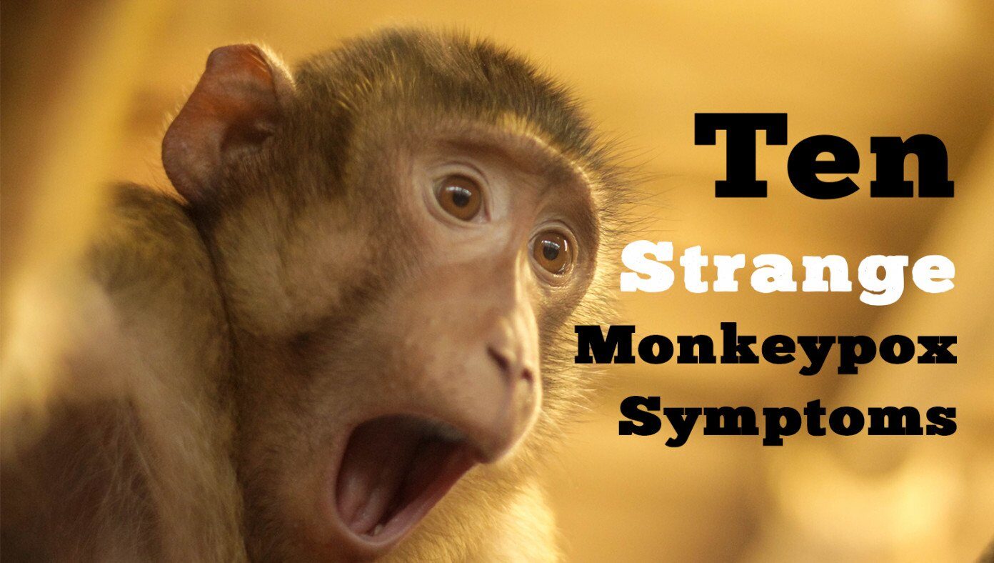 Think you have Monkeypox? Watch for these ten strange symptoms