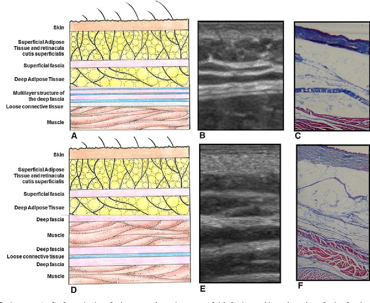 fascia layers