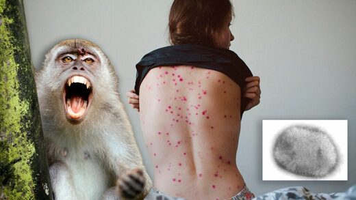 monkeypox monkey