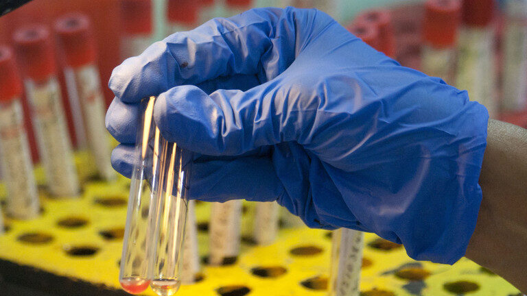 lab samples