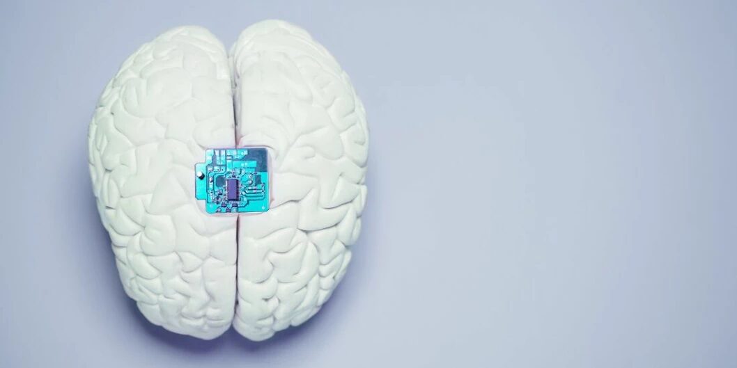 Brain Implant
