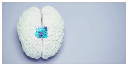 Click to enlarge Brain Implant
