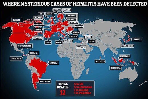 hepatitis children world