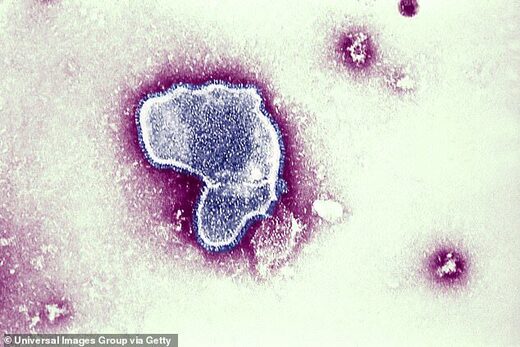 Click to enlarge RSV virus