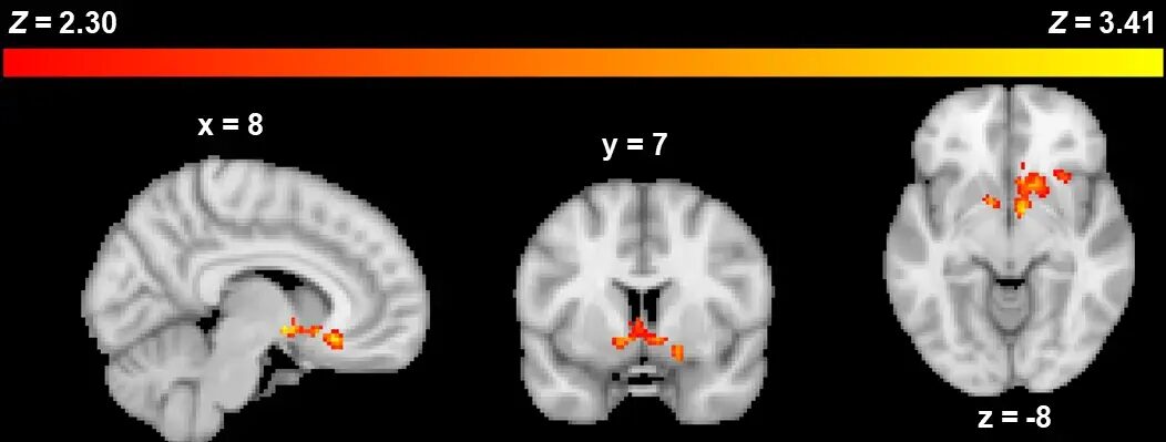 Brain Scan