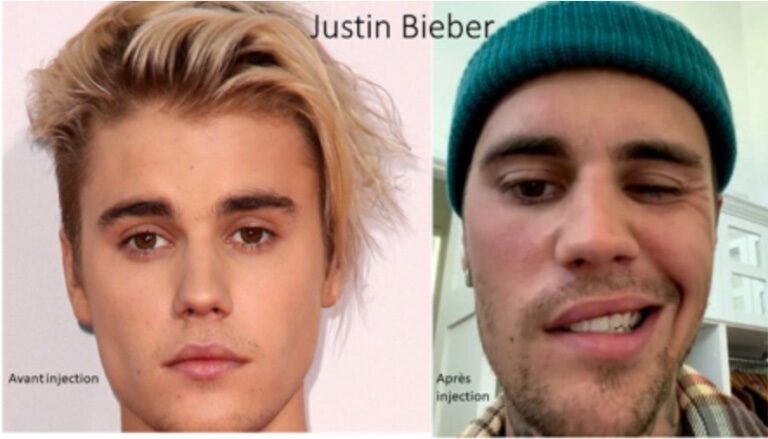 Click to enlarge Bieber himself who suffers from a mysterious illness