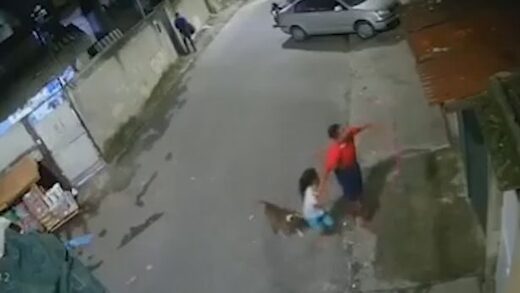 Boy left needing surgery after leg savaged in horror pitbull attack caught on CCTV in Brazil