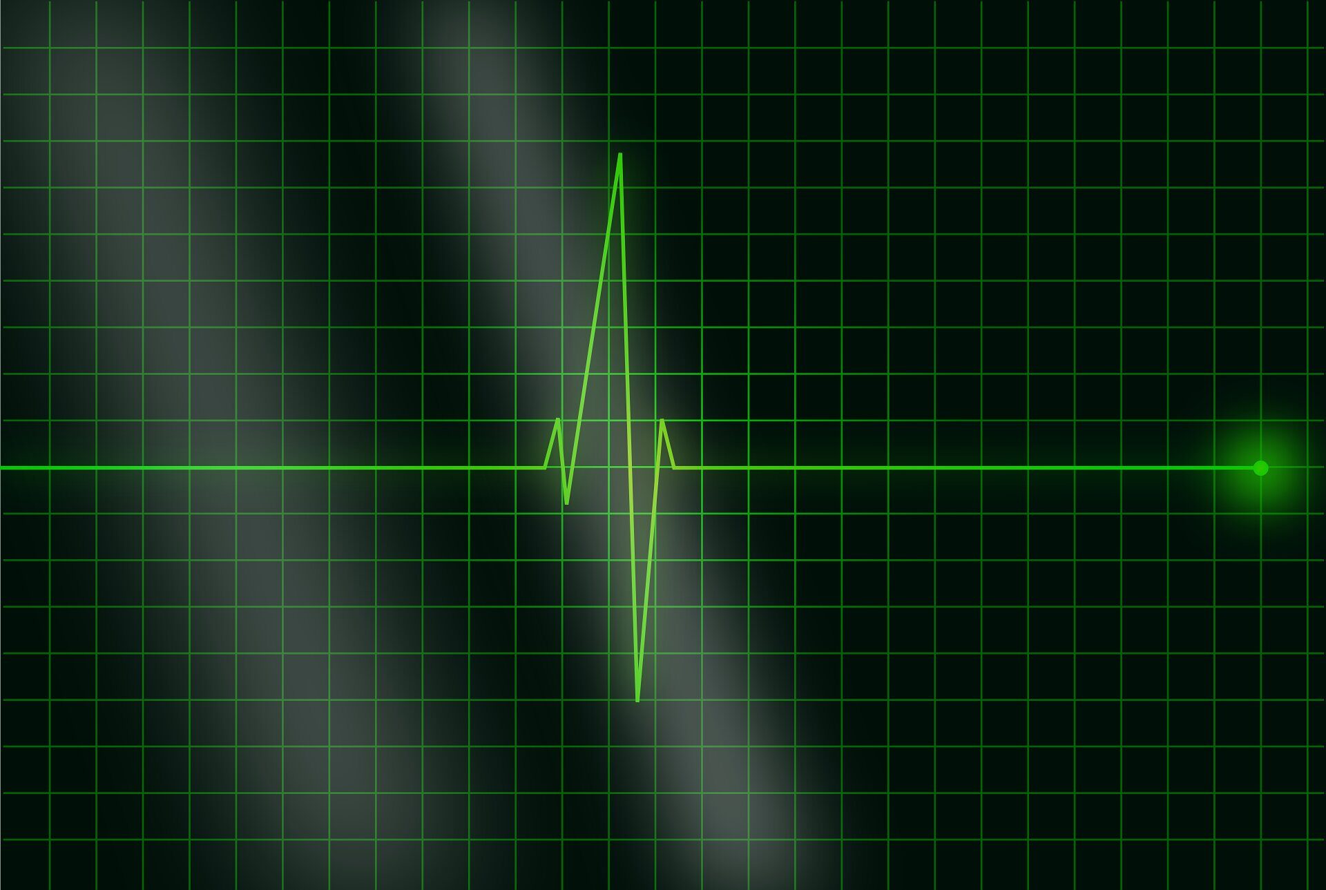 eeg image