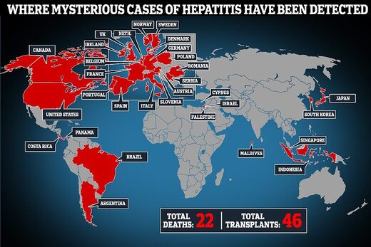 child hepatitis outbreak