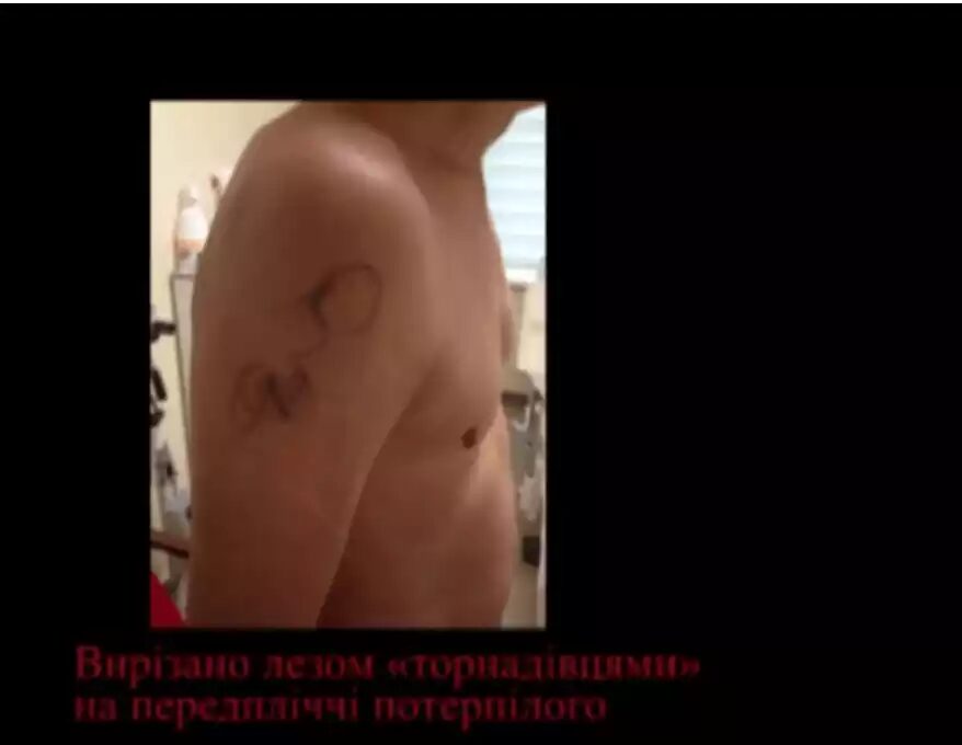 Click to enlarge torture victim ukraine