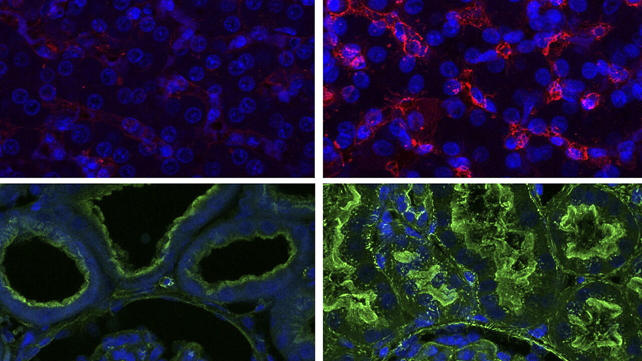 organex yale organ transplant revive dead pig cells