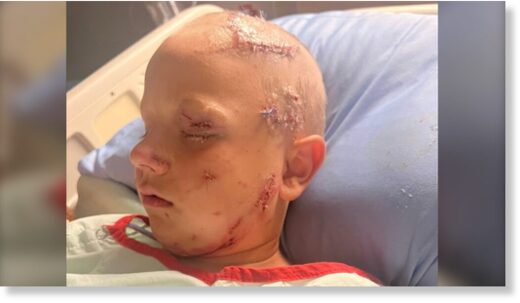 Cason, 7, was attacked by a cougar while camping near Rocky Mountain House on July 31, 2022.
