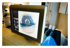 Femtosecond laser interface