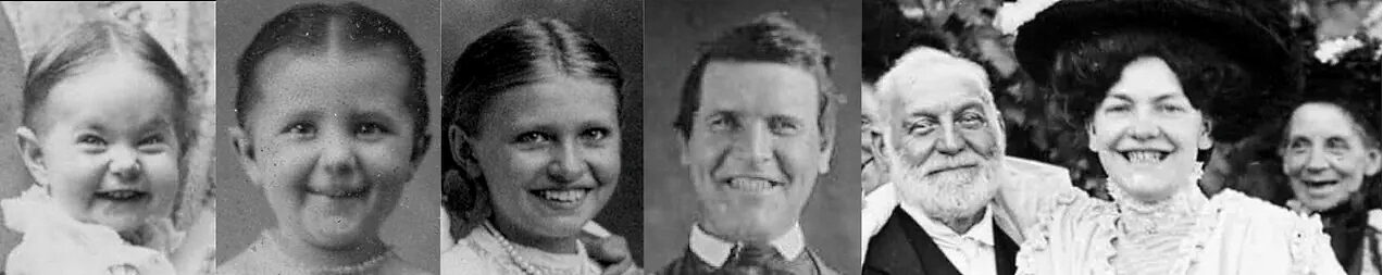 Click to enlarge facial symmety smiles good diet