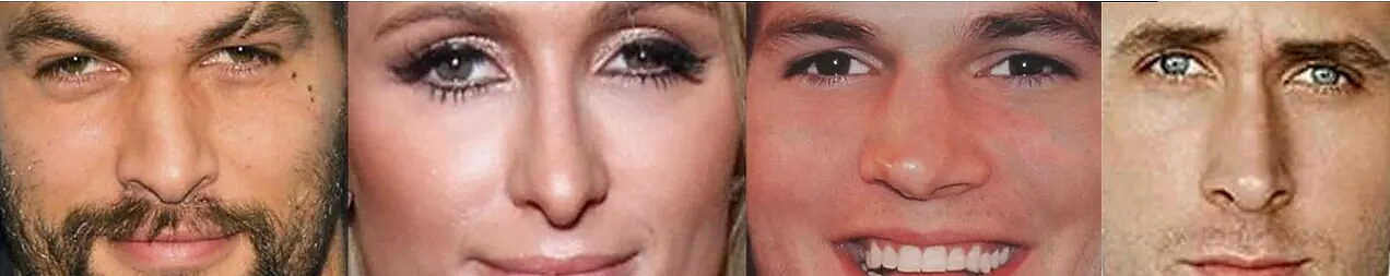 Click to enlarge eyes facial asymmetry bad diet nerve damage mercury